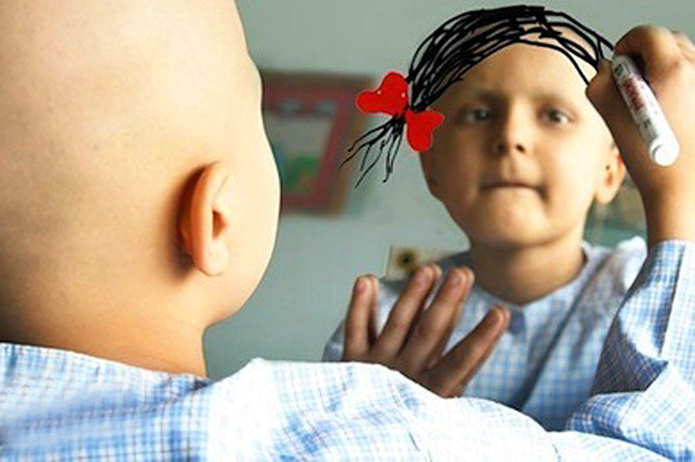 امید تازه برای درمان سرطان کشنده مغز در کودکان یافت شد